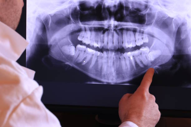 Best Knocked-Out Tooth Emergency  in Fairhope, AL